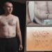 Ukrainian POW branded with ‘Glory to Russia’ says torture left him begging for death