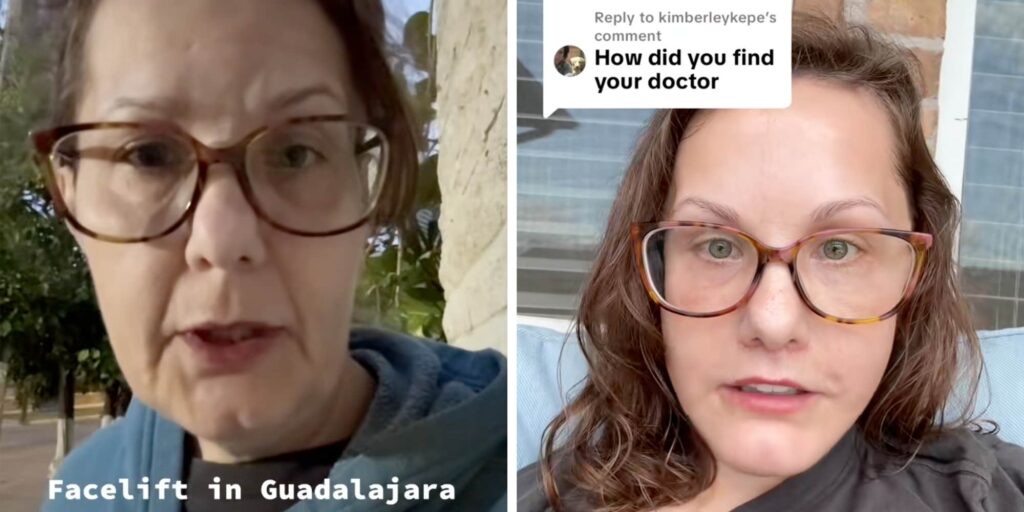 People are obsessed (and a bit unsettled) by this 50-year-old woman's viral facelift
