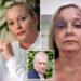 Epstein accuser Virginia Giuffre’s diary and photos reveal severe beating at hands of husband weeks before suicide: report