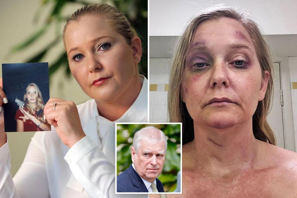 Epstein accuser Virginia Giuffre’s diary and photos reveal severe beating at hands of husband weeks before suicide: report
