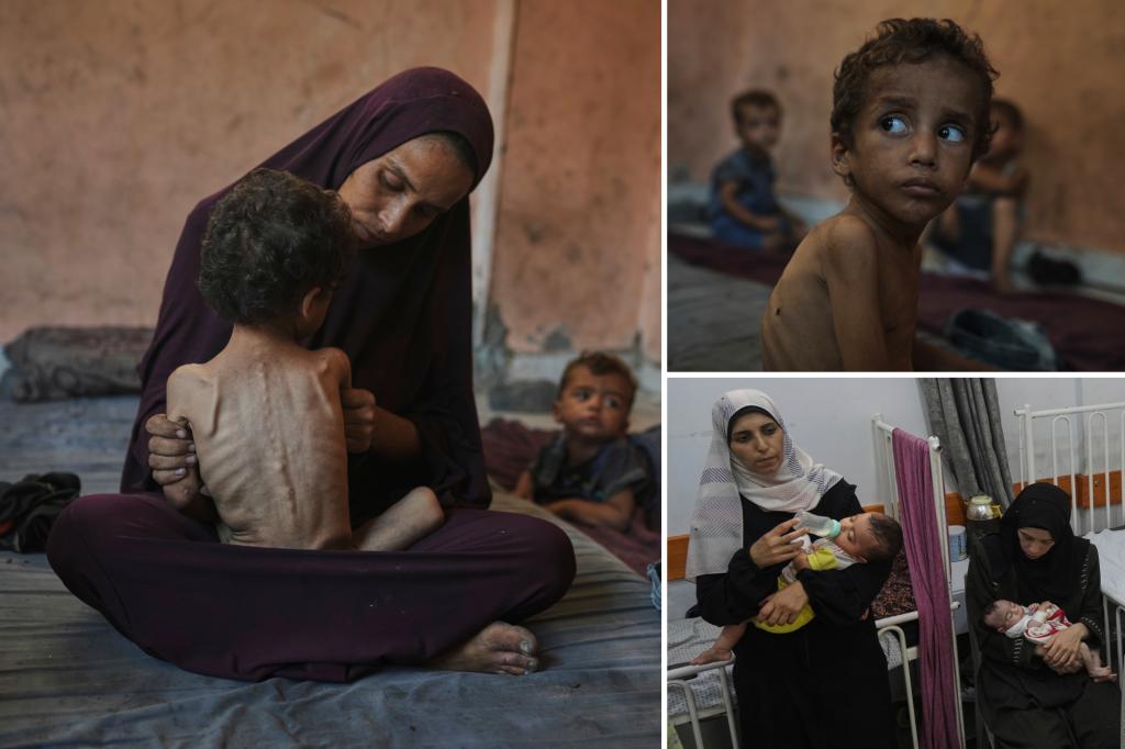 Horrifying photos show starving kids in Gaza — as Hamas made mockery of cease-fire talks with Israel