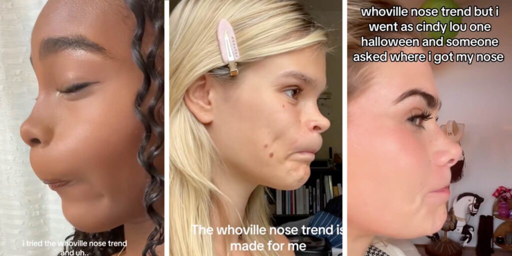 The Whoville Nose trend is taking over TikTok. Here's what it means