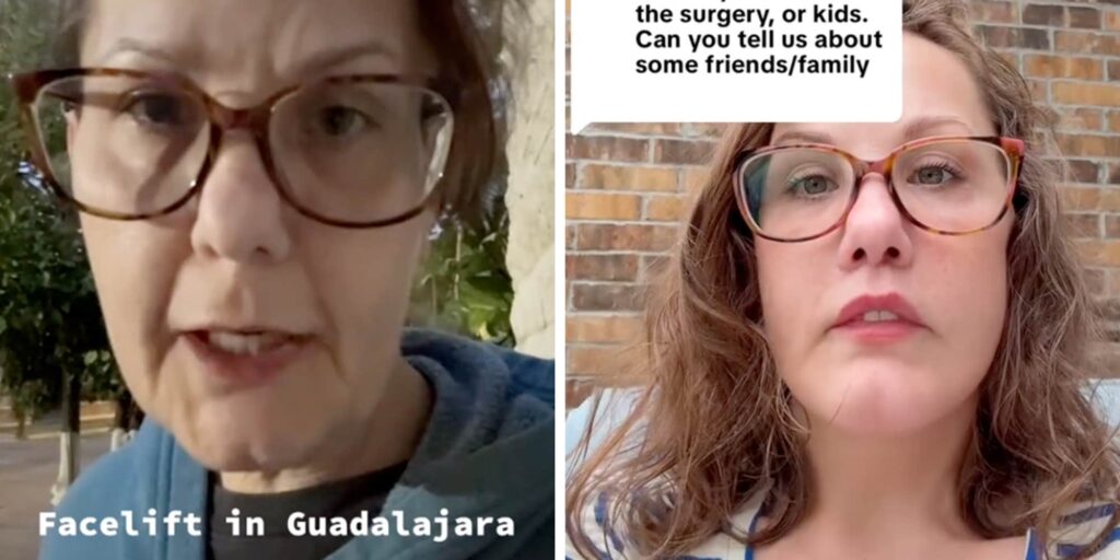 Viral "Guadalajara facelift lady" shares her kids' reactions to her dramatic new look