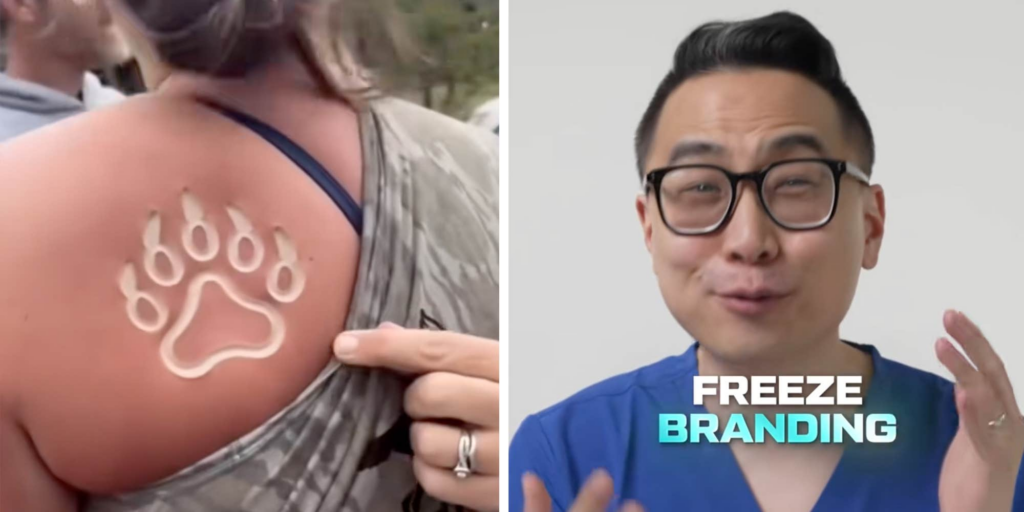 What is freeze branding? New body mod trend hits TikTok