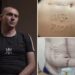Exclusive | Tortured Ukrainian POW branded with ‘Glory to Russia’ vows to return to battle after recovery: ‘Thirst for revenge’