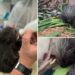 Zookeepers save life of baby porcupine with unique type of therapy