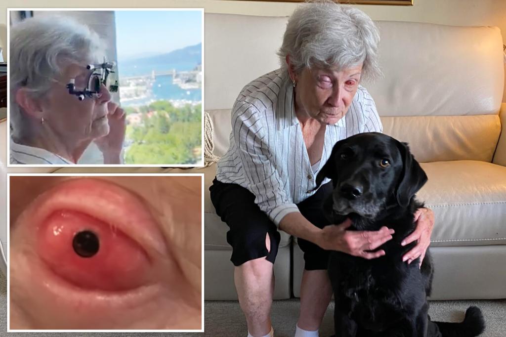 Elderly blind woman regains sight thanks to rare surgery that implants tooth into eye socket