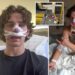 Hero American tourist and model reveals extent of facial injuries suffered while defending two women in Germany: ‘Wear my scar with pride’