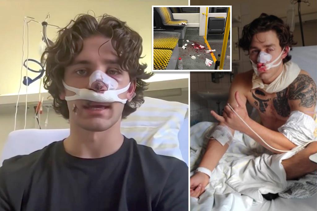 Hero American tourist and model reveals extent of facial injuries suffered while defending two women in Germany: ‘Wear my scar with pride’