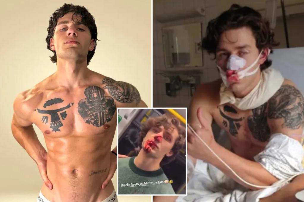 Syrian migrant accused of slashing hero American model John Rudat was previously let go by cops before being busted for gruesome attack