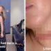 "Nearly decapitated myself": Influencer urges caution after her outfit nearly killed her