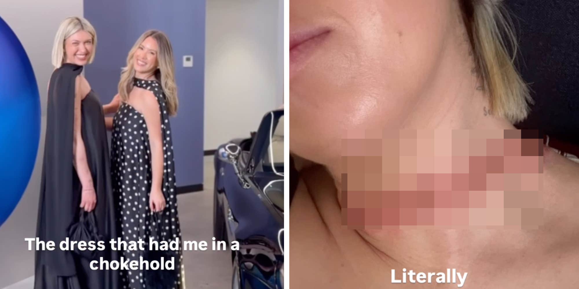 "Nearly decapitated myself": Influencer urges caution after her outfit nearly killed her