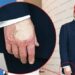 Trump, 79, Smears Right Hand In Makeup Amid Cankles Cover-Up