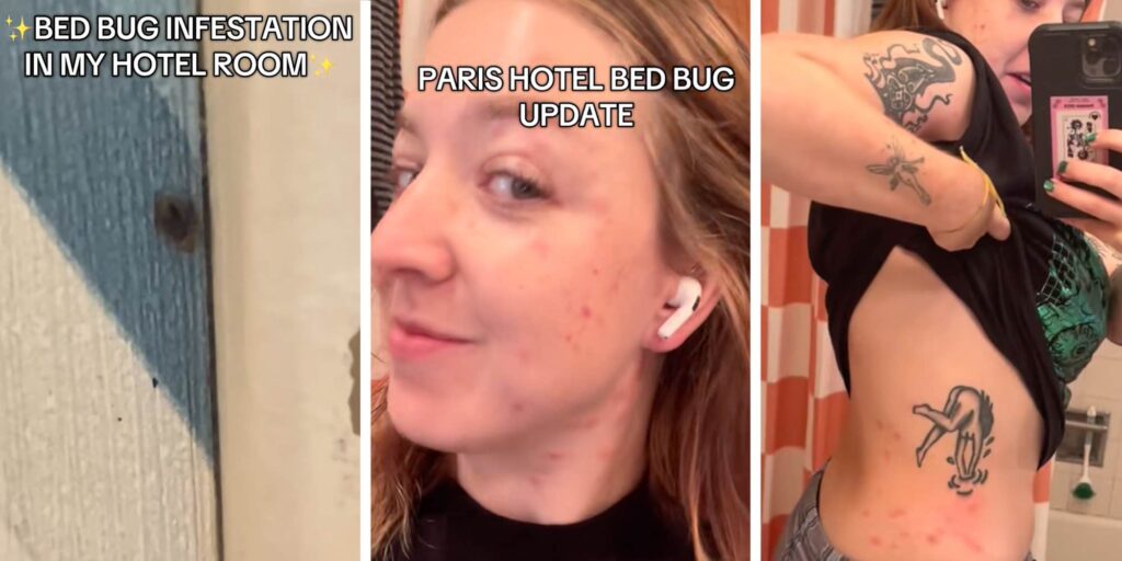 "You REALLY need to call the airline": Woman stays in Paris hotel crawling with bedbugs, then flies home