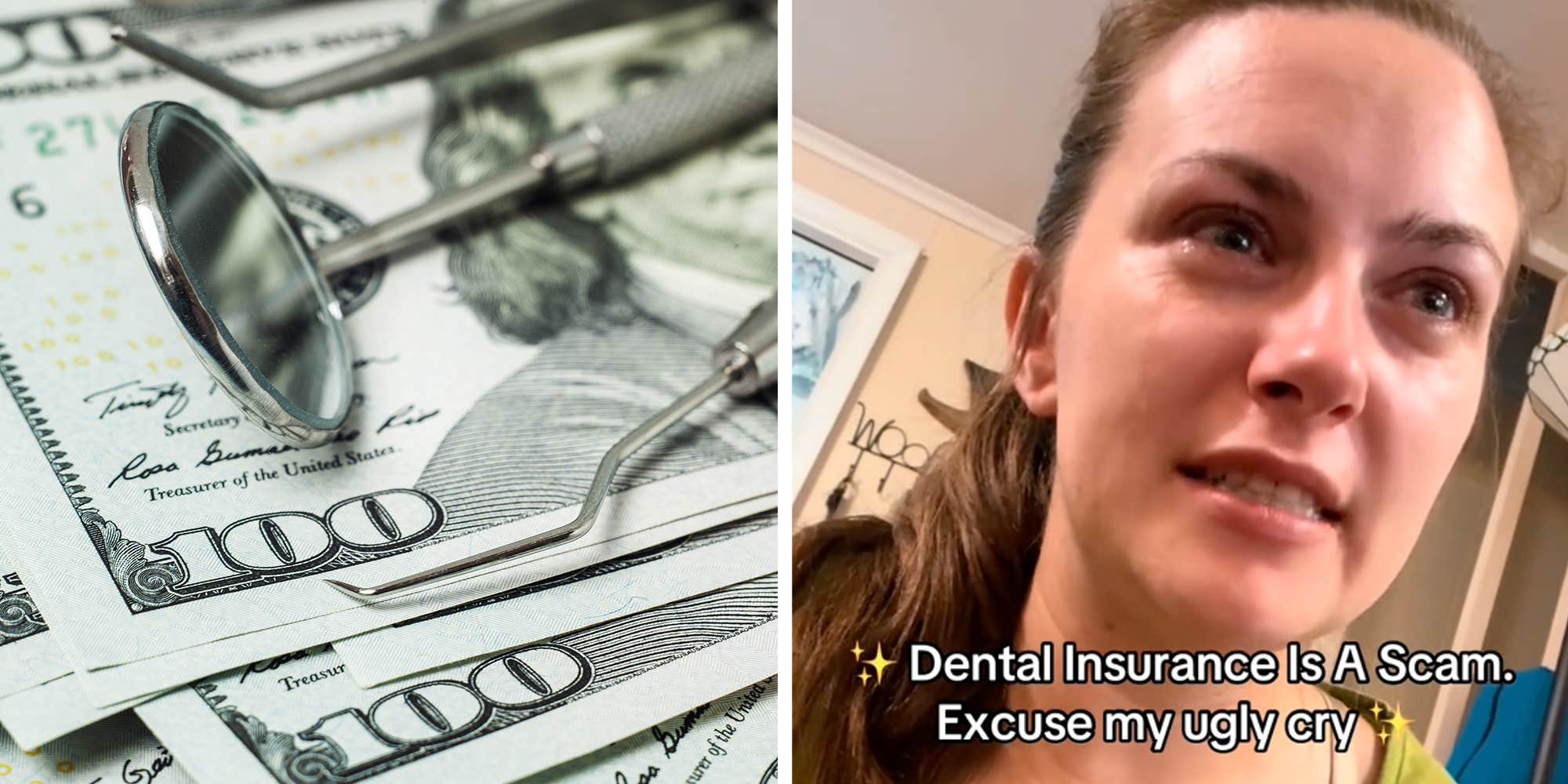 "Dental care should be considered necessary healthcare for all": Woman says dental insurance "literally covers nothing" after $9K estimate
