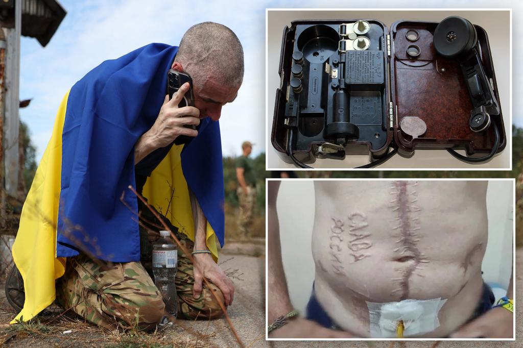 Russia torturing Ukrainians with electric shock to genitals from phone known as a ‘Call to Putin’