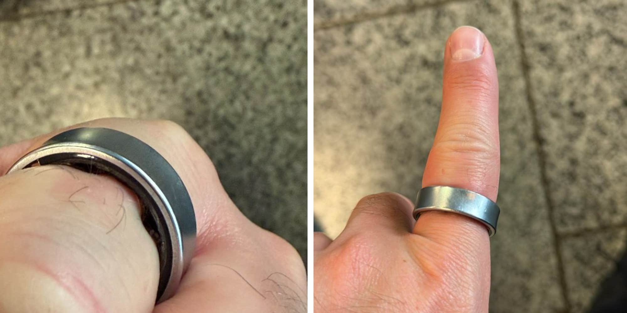 "New nightmare just dropped": Samsung Galaxy Ring swells on man's finger before flight, sending him to the hospital