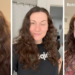 Woman shares warning after "botox fail" leaves her with one closed eye