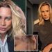 Fashion influencer dead after complaining about complications from ‘fox eyes’ surgery