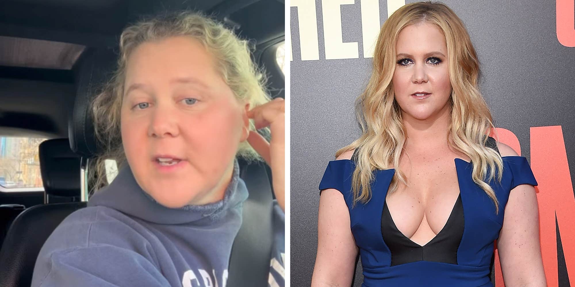 "I wanted to keep it real": Amy Schumer just dropped a new photo and suddenly everyone's talking about her legs