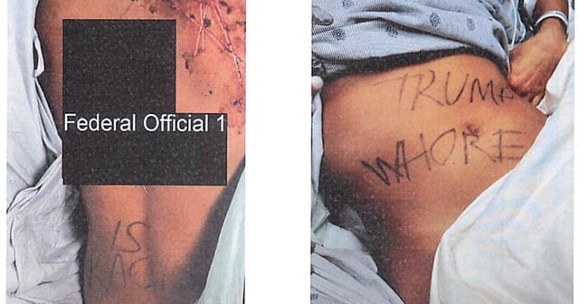 Republican Aide Charged With Faking Violent Leftist Attack on Herself | A former aide for a Republican representative is accused of staging an elaborate attack and lying to law enforcement about it.