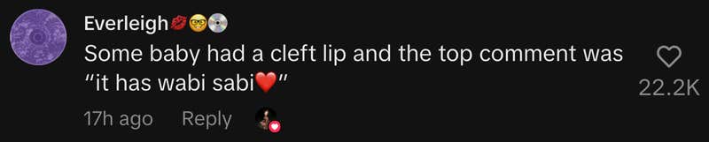 “Some baby had a cleft lip and the top comment was ‘it has wabi sabi❤️.’”