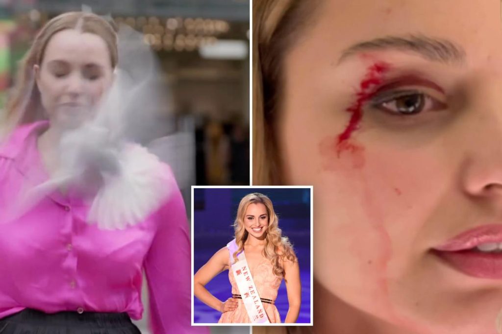 New Zealand reporter bloodied by flying bird in the middle of news segment