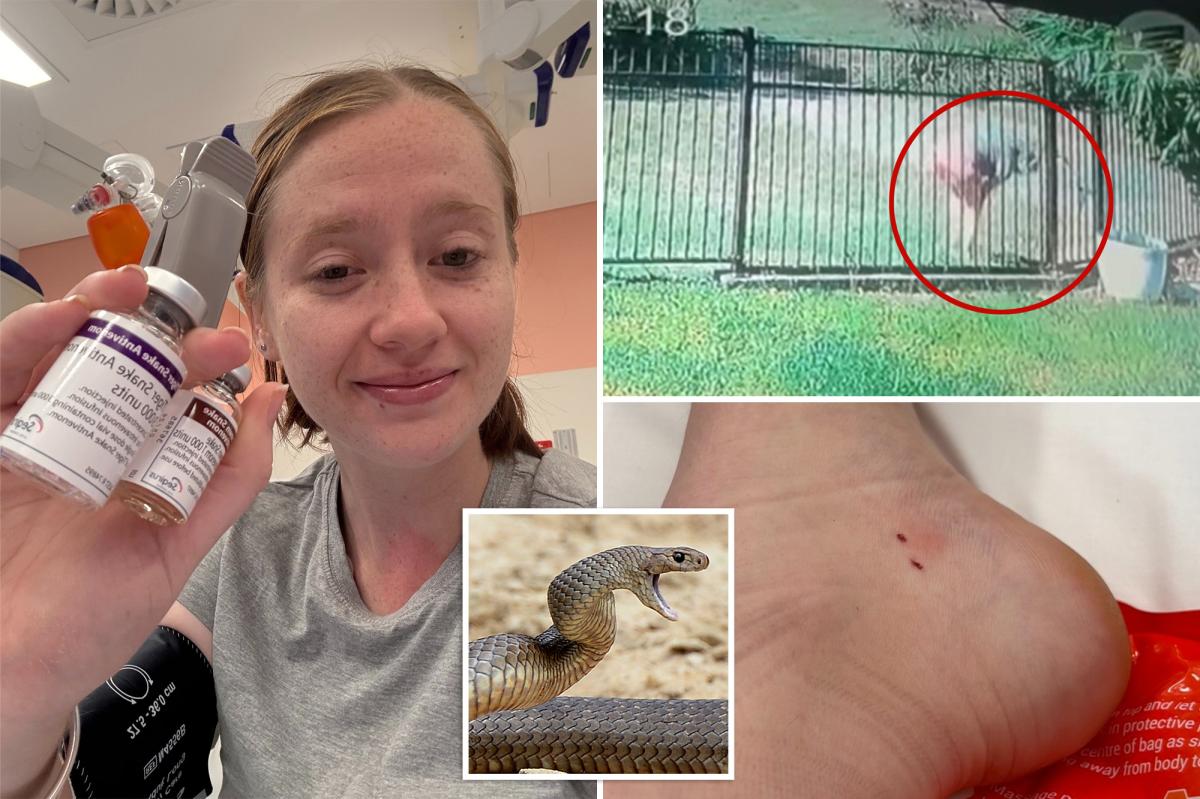 Popular snake catcher recounts ‘freak’ moment she was bitten by extremely venomous serpent