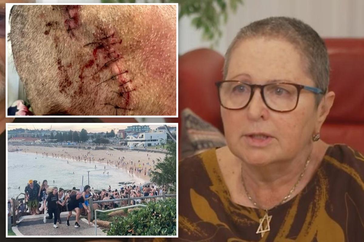 Bondi Beach victim outraged after her name was changed by hospital during treatment: ‘Ripped of my identity’